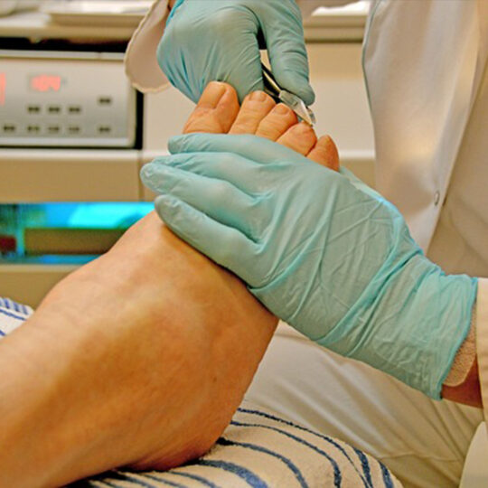 Medic Feet-Tratamiento de Uñas Encarnadas